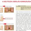 EGYENES LÉPTETŐ (NŐI,FÉRFI) 634